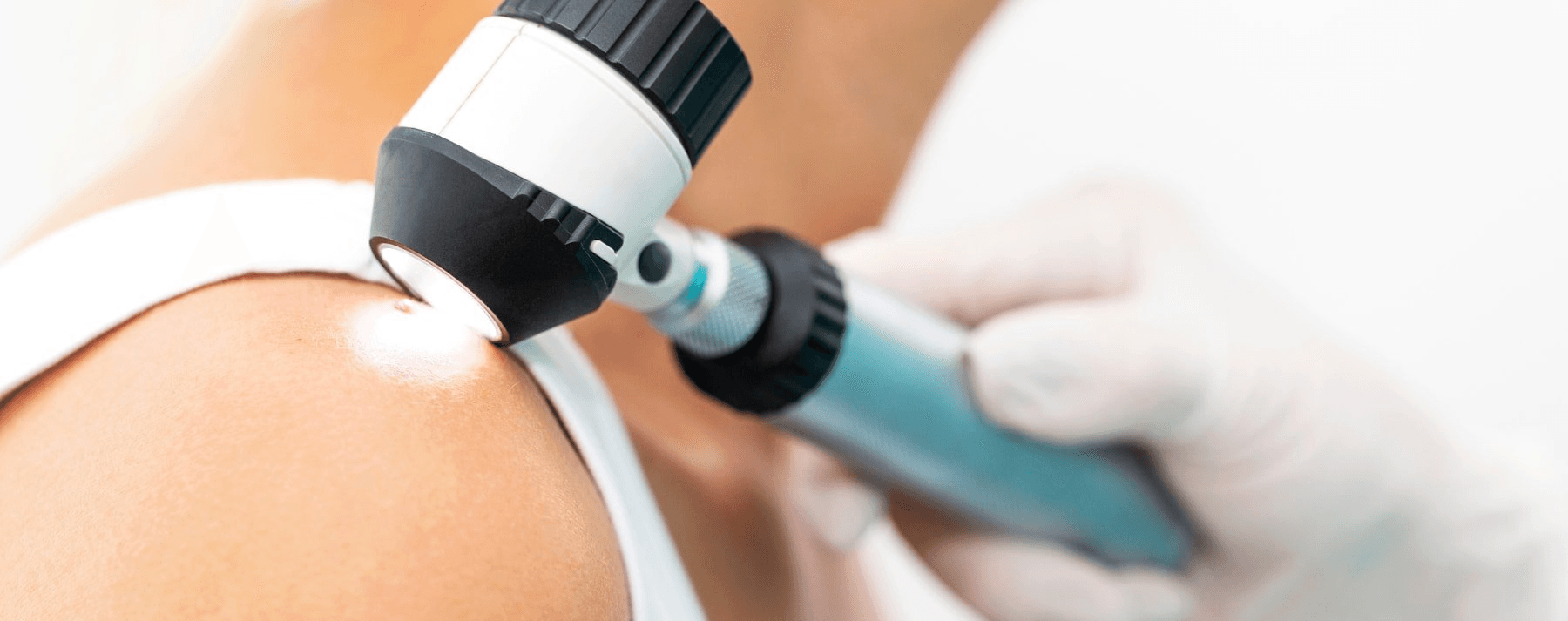 Close up of a dermatascope on the skin